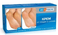 До и После крем от трещин в ступнях 150мл