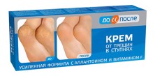 До и После крем от трещин в ступнях 50мл