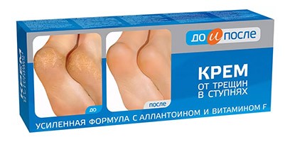 До и После крем от трещин в ступнях 50мл